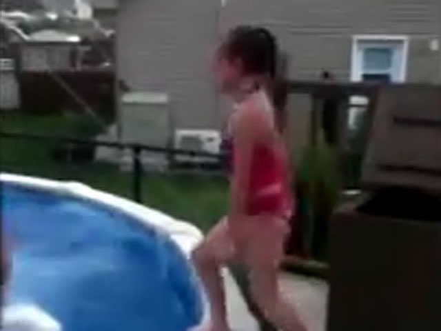 Kid leg break near pool